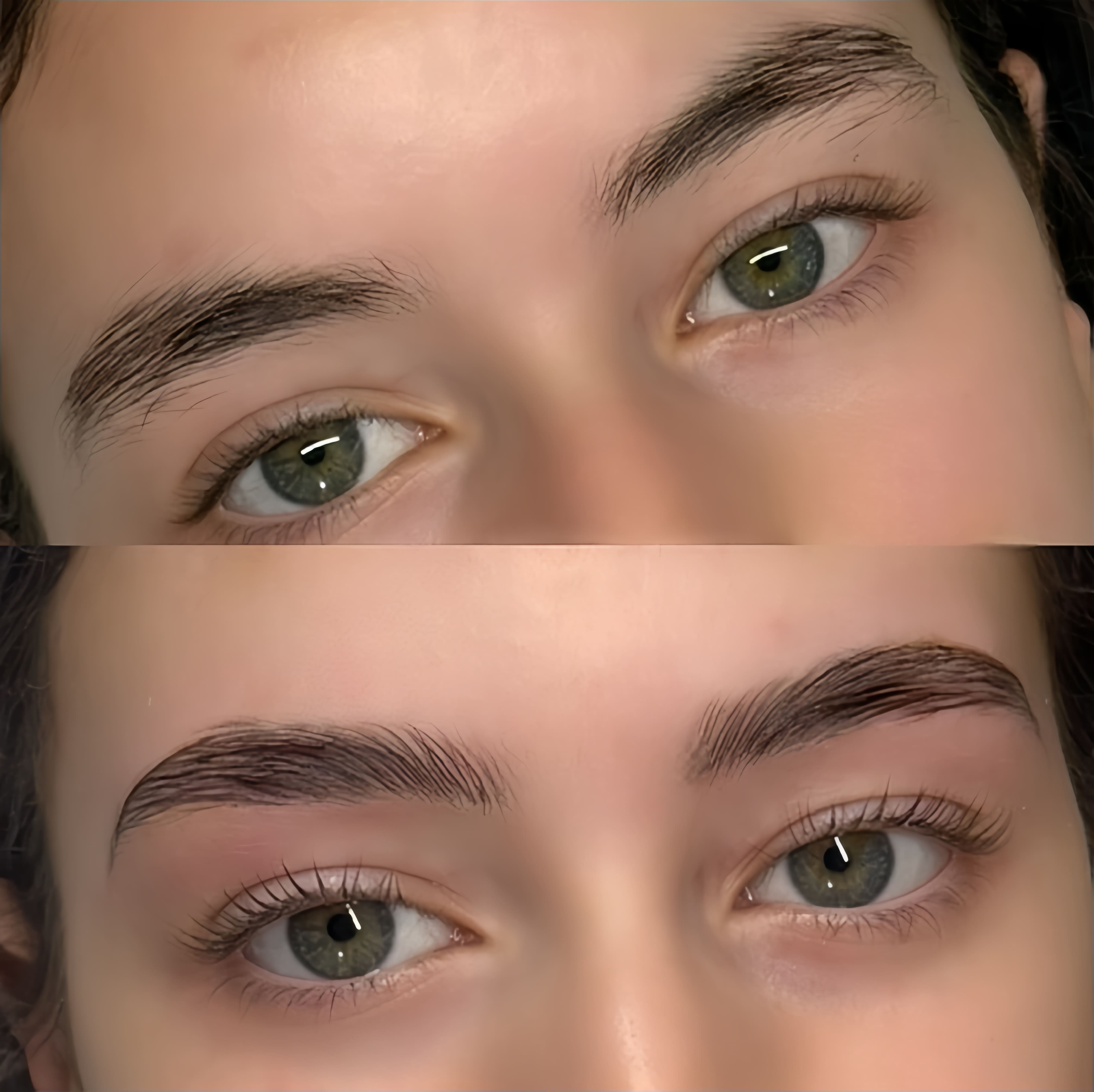 Avant/Après Brow Lift — AM Institut Avignon